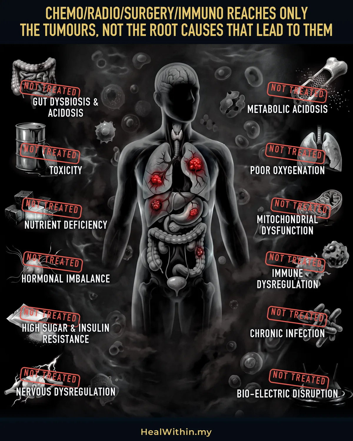 What these treatments reach: the same body and the same Root Causes as theearlier infographic, with everything drained to grey except the tumours, which burn red in both lungs, the liver, the stomach and the colon. Colour marks what the treatment reaches, and it reaches only the tumour. Every one of the RootCauses around the body is stamped NOT TREATED: gut dysbiosis and acidosis, toxicity, nutrient deficiency, hormonal imbalance, high sugar and insulin resistance, nervous dysregulation, metabolic acidosis, poor oxygenation, mitochondrial dysfunction, immune dysregulation, chronic infection and bio-electric disruption. The spoiled environment around the cells is unchanged.